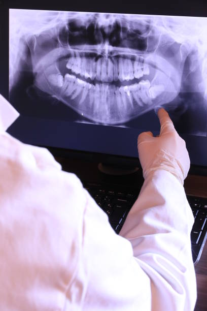 Best Dental Abscess Treatment in Stroudsburg, PA