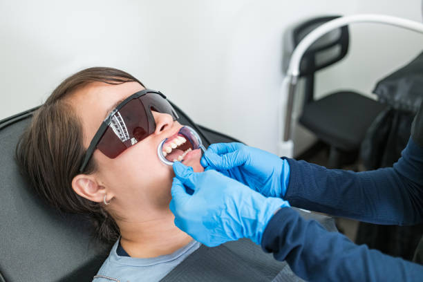 Best Knocked-Out Tooth (Avulsed Tooth) Treatment in Stroudsburg, PA